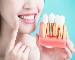 Get Teeth Whitening in Houston TX and Flaunt a Great Smile