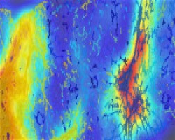 PharmaNest Announces New Pre-Clinical and Clinical NASH Data to Be Presented at the AASLD The Liver